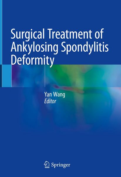 Produktbild: Surgical Treatment of Ankylosing Spondylitis Deformity