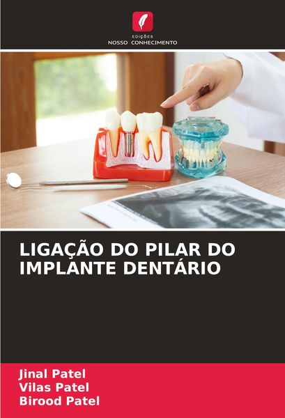 Produktbild: Liga&ccedil;&atilde;o Do Pilar Do Implante Dent&aacute;rio