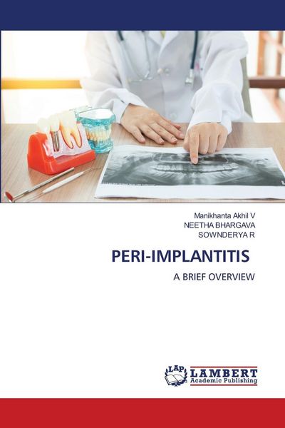 Produktbild: Peri-Implantitis