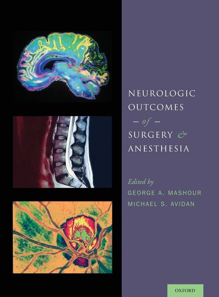 Produktbild: Neurologic Outcomes of Surgery and Anesthesia
