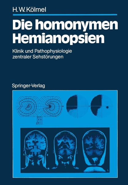 Produktbild: Die homonymen Hemianopsien