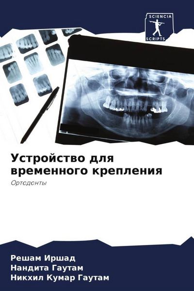Produktbild: Ustrojstwo dlq wremennogo krepleniq