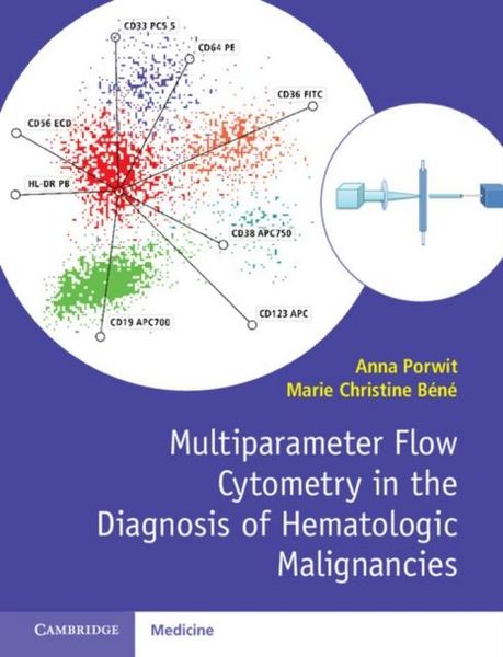 Produktbild: Multiparameter Flow Cytometry in the Diagnosis of Hematologic Malignancies