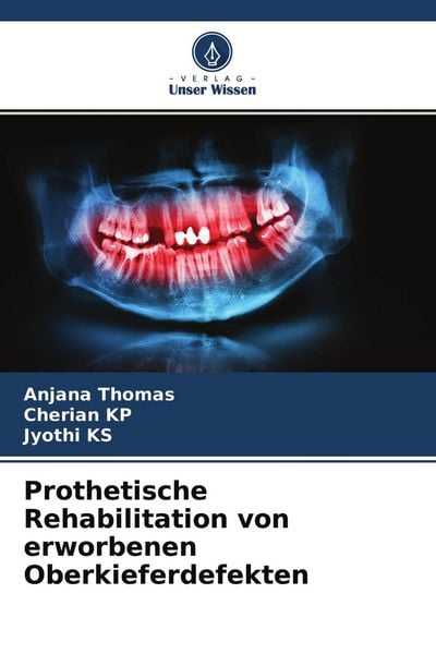 Prothetische Rehabilitation von erworbenen Oberkieferdefekten, Taschenbuch von Anjana Thomas , Cherian KP , Jyothi KS, Verlag Unser Wissen,