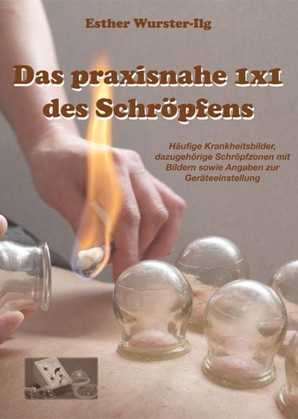 Das praxisnahe 1 x 1 des Schröpfens, Gebundene Ausgabe von Esther Wurster-Ilg, Westarp BookOnDemand, 9783863862183