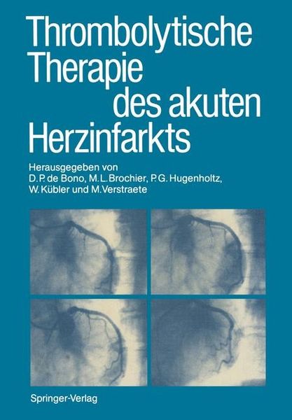 Produktbild: Thrombolytische Therapie des akuten Herzinfarkts