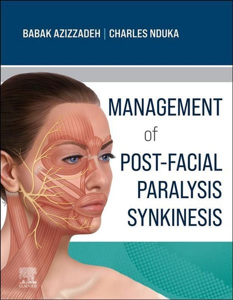 Produktbild: Management of Post-Facial Paralysis Synkinesis