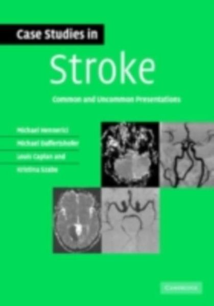 Produktbild: Case Studies in Stroke