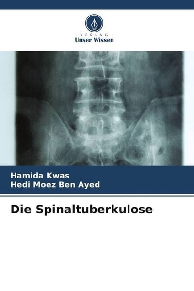 Die Spinaltuberkulose, Taschenbuch von Hamida Kwas , Hedi Moez Ben Ayed, Verlag Unser Wissen, 9786205978979