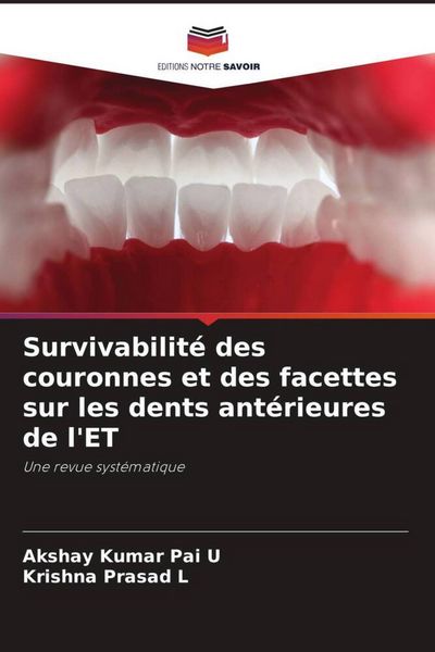 Produktbild: Survivabilit&eacute; des couronnes et des facettes sur les dents ant&eacute;rieures de l'ET