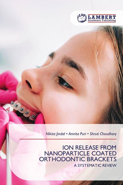 Produktbild: Ion Release from Nanoparticle Coated Orthodontic Brackets