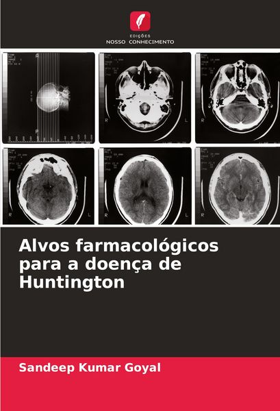 Produktbild: Alvos farmacol&oacute;gicos para a doen&ccedil;a de Huntington
