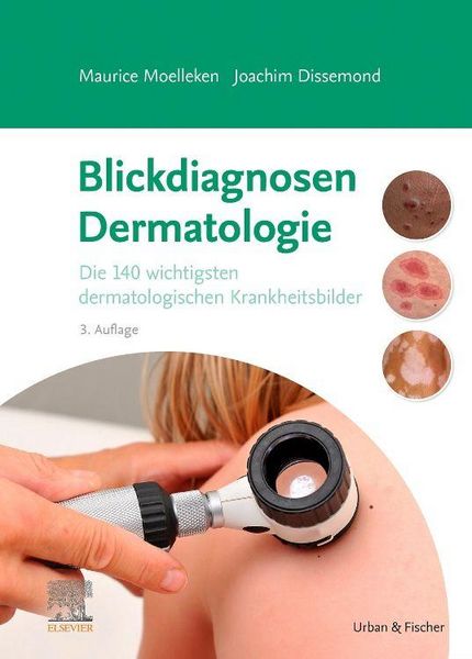 Blickdiagnosen Dermatologie, Gebundene Ausgabe von Maurice Moelleken,Joachim Dissemond, Urban & Fischer in Elsevier, 978-3-437-21383-0