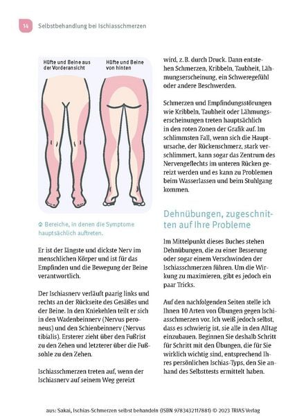 Produktbild: Ischias-Schmerzen selbst behandeln