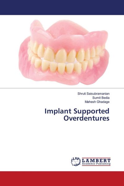 Produktbild: Implant Supported Overdentures