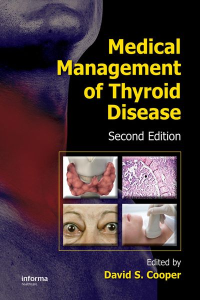Produktbild: Medical Management of Thyroid Disease