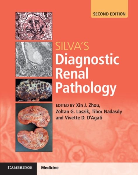 Produktbild: Silva's Diagnostic Renal Pathology