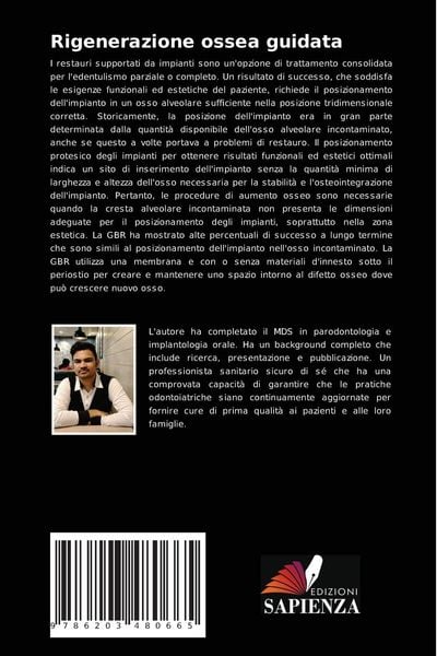 Produktbild: Rigenerazione ossea guidata