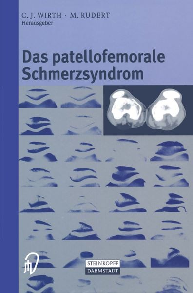 Produktbild: Das patellofemorale Schmerzsyndrom