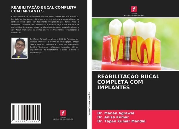 Produktbild: Reabilita&ccedil;&atilde;o Bucal Completa Com Implantes
