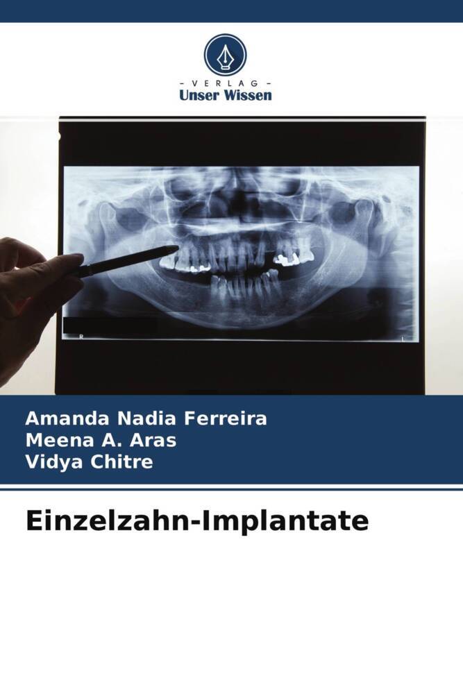 Einzelzahn-Implantate, Taschenbuch von Amanda Nadia Ferreira , Meena A. Aras , Vidya Chitre, Verlag Unser Wissen, 9786204707099