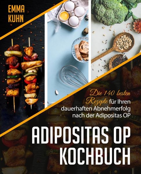 Produktbild: Adipositas OP Kochbuch