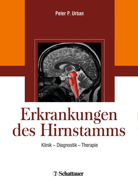 Produktbild: Erkrankungen des Hirnstamms