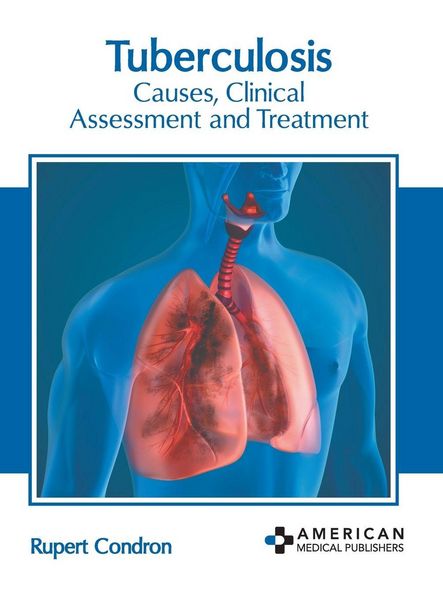 Produktbild: Tuberculosis: Causes, Clinical Assessment and Treatment