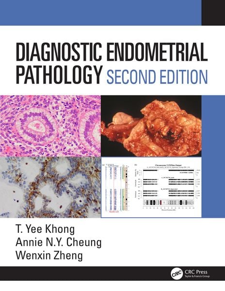 Produktbild: Diagnostic Endometrial Pathology 2E