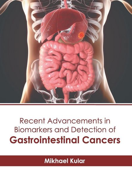 Produktbild: Recent Advancements in Biomarkers and Detection of Gastrointestinal Cancers