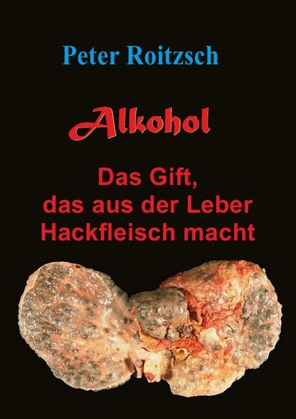 Produktbild: Alkohol - Das Gift, das aus der Leber Hackfleisch macht