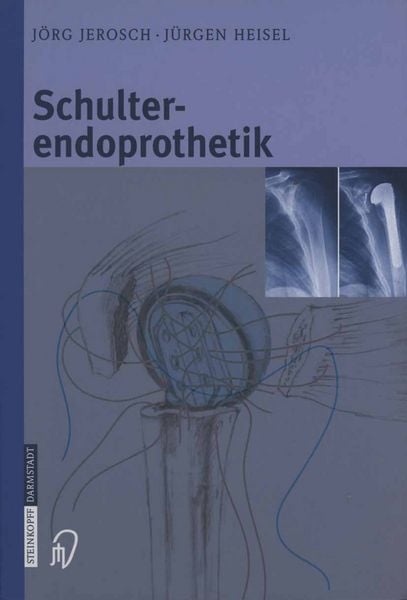 Produktbild: Schulterendoprothetik
