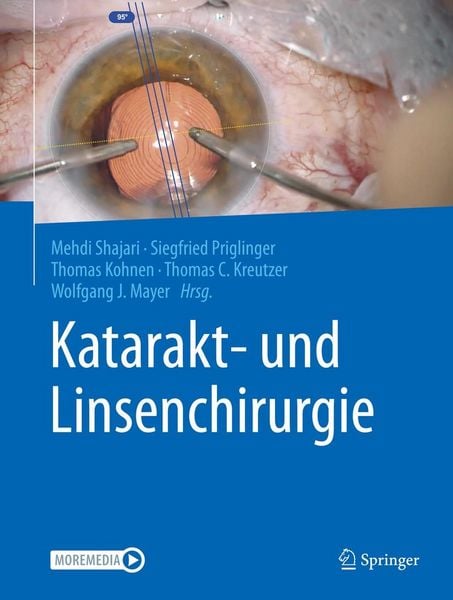 Produktbild: Katarakt- und Linsenchirurgie