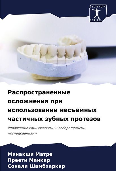 Produktbild: Rasprostranennye oslozhneniq pri ispol'zowanii nes#emnyh chastichnyh zubnyh protezow