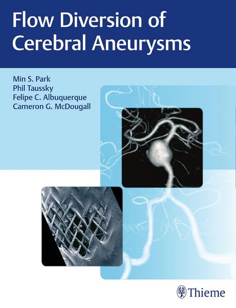 Produktbild: Flow Diversion of Cerebral Aneurysms