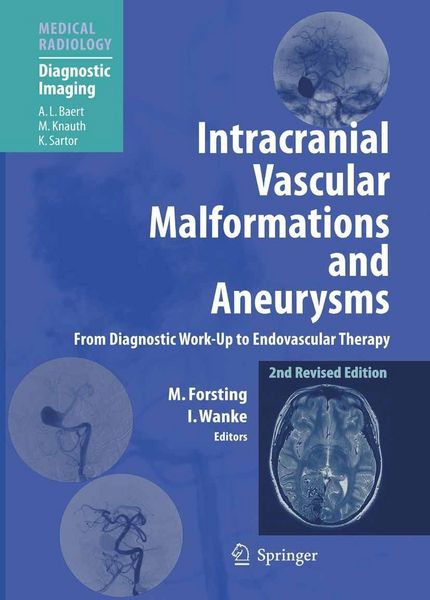 Produktbild: Intracranial Vascular Malformations and Aneurysms