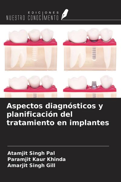Produktbild: Aspectos diagn&oacute;sticos y planificaci&oacute;n del tratamiento en implantes
