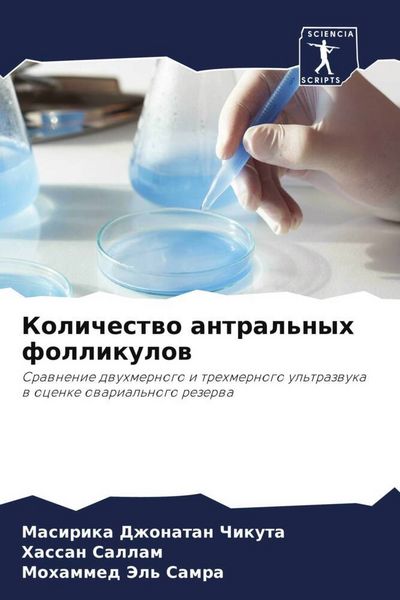Produktbild: Kolichestwo antral'nyh follikulow