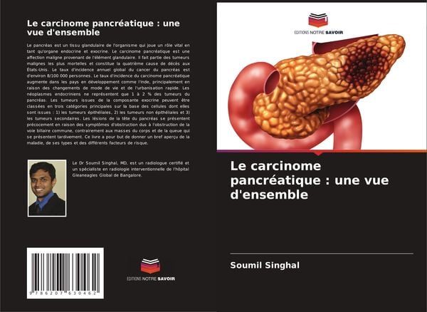 Produktbild: Le carcinome pancr&eacute;atique : une vue d'ensemble