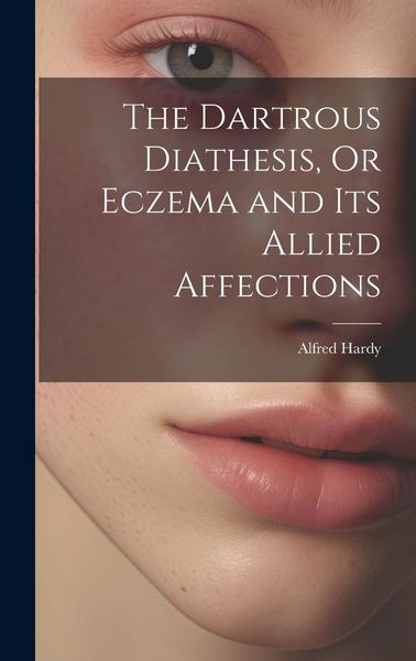 Produktbild: The Dartrous Diathesis, Or Eczema and Its Allied Affections