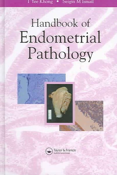 Produktbild: Handbook of Endometrial Pathology