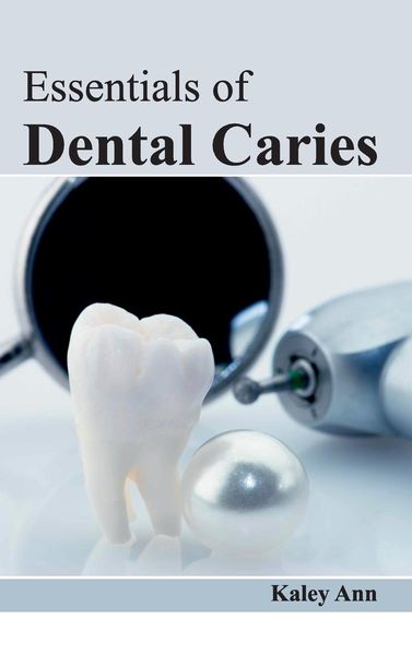 Produktbild: Essentials of Dental Caries