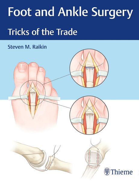 Produktbild: Foot and Ankle Surgery