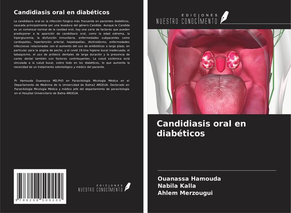 Produktbild: Candidiasis oral en diab&eacute;ticos