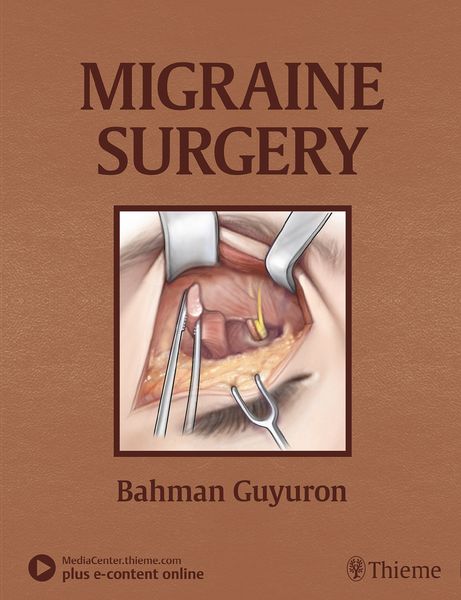 Produktbild: Migraine Surgery