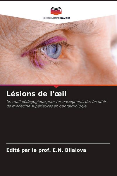 Produktbild: L&eacute;sions de l'&iquest;il