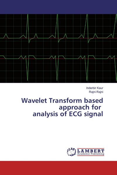 Produktbild: Wavelet Transform based approach for analysis of ECG signal