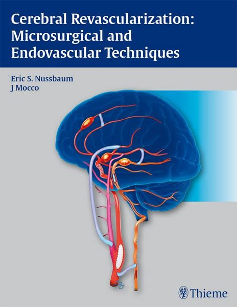 Produktbild: Cerebral Revascularization: Microsurgical and Endovascular Techniques