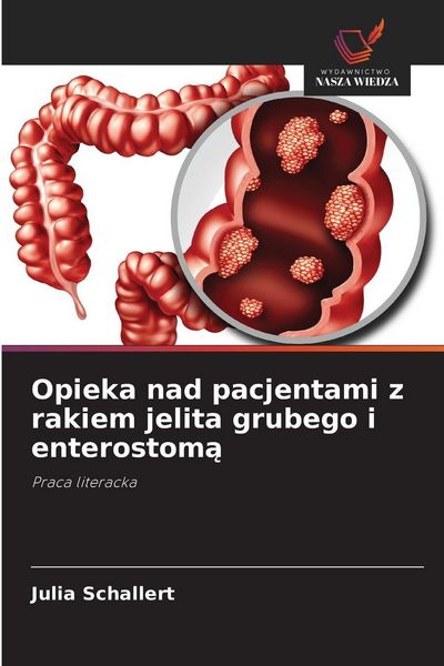 Produktbild: Opieka nad pacjentami z rakiem jelita grubego i enterostom&iquest;