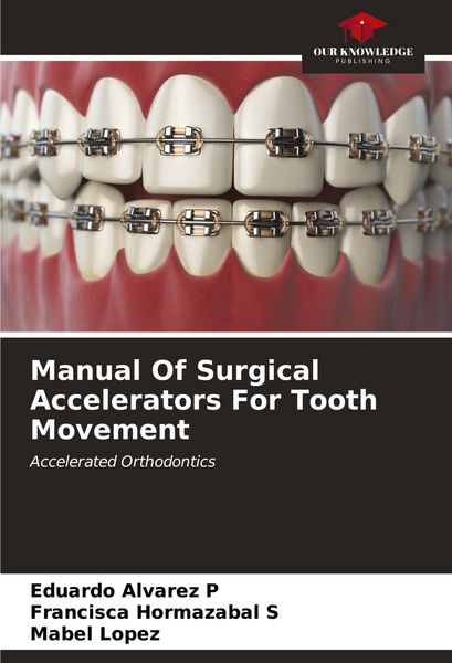Produktbild: Manual Of Surgical Accelerators For Tooth Movement